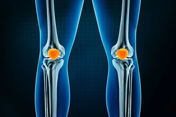 小卫星或膝盖骨X光前视或前视 人体骨骼 腿或下肢骨骼骨学三维绘制图解 解剖学 生物学 保健概念 — 图库照片