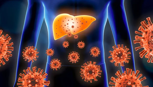 stock image Hepatitis 3d rendering illustration with red virus cells and human body. Viral, infectious and inflammatory hepatic or liver disease, medical and healthcare concepts.