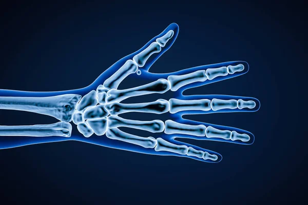 stock image X-ray dorsal or posterior view of right human hand bones with body contours 3D rendering illustration. Skeletal anatomy, osteology, science, biology, medical and healthcare concept.