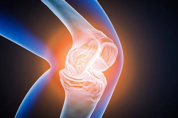 Human Knee Joint Bones Inflammation Injury Pain Rendering Illustration Articular — Stock Photo, Image