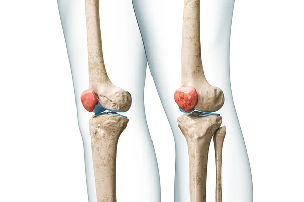 小卫星或膝盖骨为红色 身体3D渲染图形 白色与复制空间隔离 人体骨骼和膝盖骨解剖 医学图表 骨理学 骨骼系统概念 — 图库照片