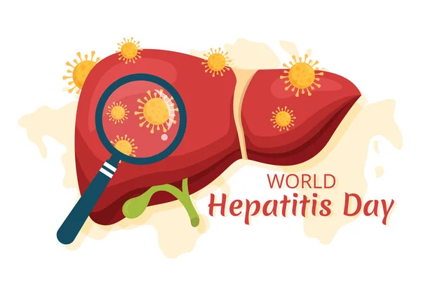 Světová Vektorová Ilustrace Den Hepatitidy Nemocných Jater Rakoviny Cirhózy Zdravotnictví — Stockový vektor