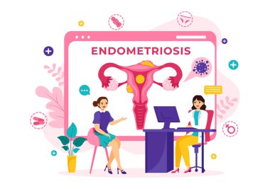 Endometriosis Vector Illustration with Condition the Endometrium Grows Outside the Uterine Wall in Women for Treatment in Flat Cartoon Background clipart