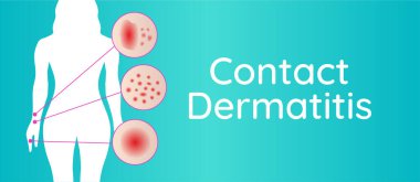 Kadın ve Sinir Kapanışlarıyla Dermatit Arkaplan Resimleri