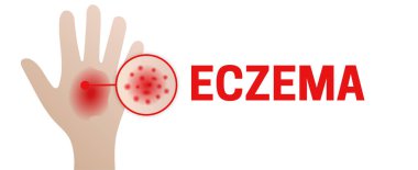 Egzama Arkaplan Çizim Tasarımı