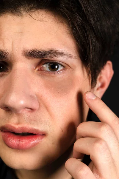 Close Portrait Young Homeless Guy Pointing His Finger Bruises His — Stock Photo, Image