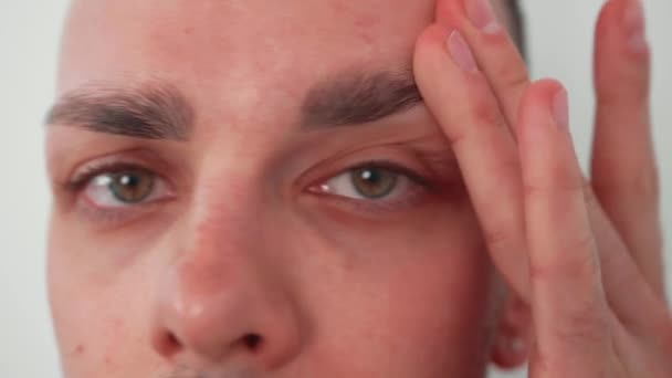 Yakın Çekim Ayna Yansıması Genç Beyaz Adam Kuru Sağlıksız Cilt — Stok video