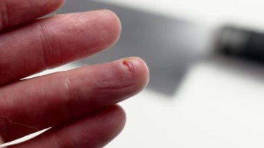 Masada bulanık bir şekilde duran bıçağın arka planına karşı mutfakta çalışırken bir parmak yaralanması ya da kesik. Dikkat konsepti