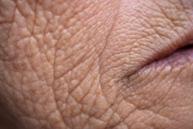 Yaşlı bir kadının yüzünün makro fotoğrafçılığı. Derisi zamanla işaretlenmiş, derin kırışıklıklarla dolu. Buruşuk cilt. Yaşlılık belirtileri.