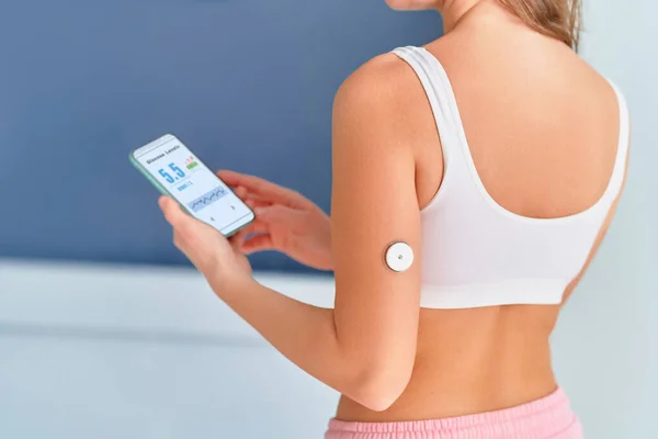 Uzak Glikoz Izleme Için Sensör Telefon Kullanan Şeker Hastası Şeker — Stok fotoğraf