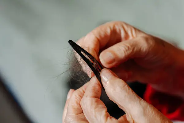 a woman\'s hair fell out due to cancer. the hair on the barrette is due to chemotherapy. scraps of hair due to cancer on the hairstyle holder