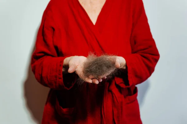 balding grandmother from chemotherapy. hair loss in a woman due to a cancerous tumor. a piece of hair in grandmother\'s hands because of cancer