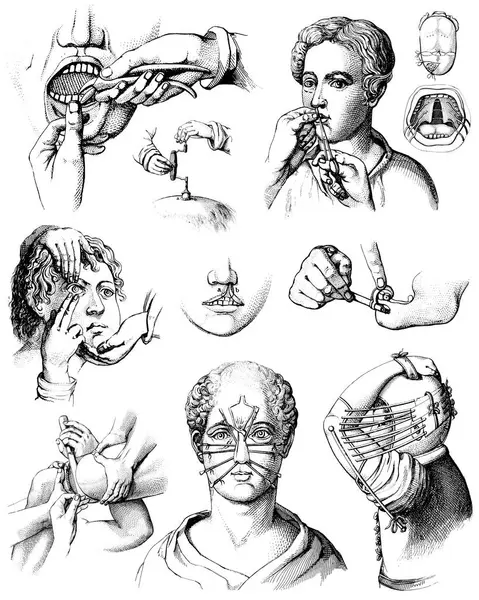 Victorian Anatomical Drawings Early Surgical Techniques Isolated White Background Royalty Free Stock Photos