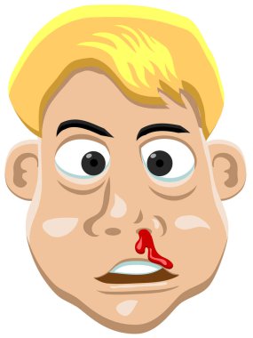 Kanlı burunlu, sarı saçlı bir adam.