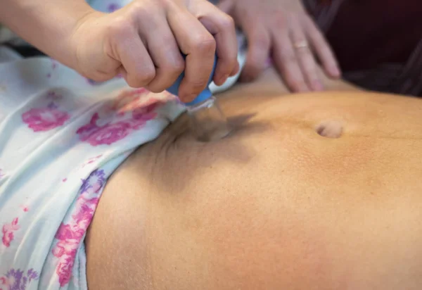stock image Postpartum doula shows how to massage a cesarean scar with a vacuum jar. Recovery procedures after childbirth.