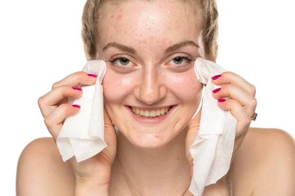 Young Happy Woman Removing Makeup Wet Tissues White Background — Fotografia de Stock