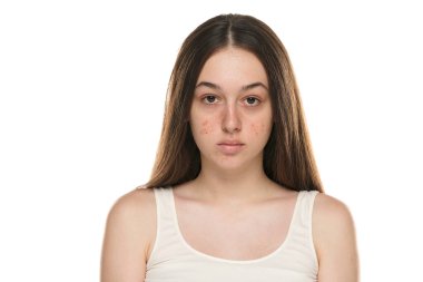 Problemati tenli güzel genç kadınlar.