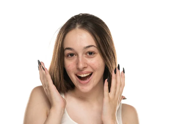 Όμορφες Νεαρές Χαρούμενες Γυναίκες Προβληματικό Δέρμα Λευκό Φόντο — Φωτογραφία Αρχείου