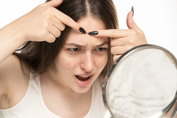 Mujer Joven Nerviosa Con Piel Problemática Apretar Granos Frente Blanco —  Fotos de Stock