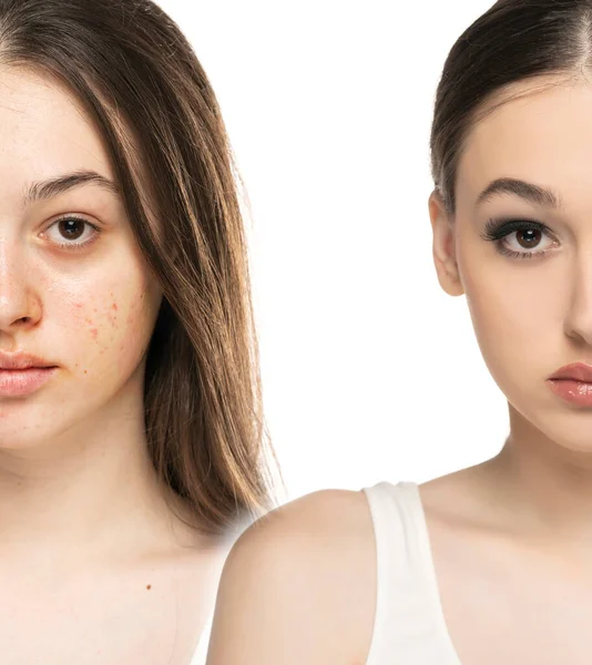 Retrato Comparativo Una Joven Sin Con Maquillaje — Foto de Stock