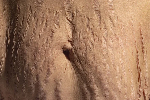 Zamknij Ludzką Skórę Naturalne Rozstępy Tekstura Tła Rozstępy Kobieta Brzuch — Zdjęcie stockowe