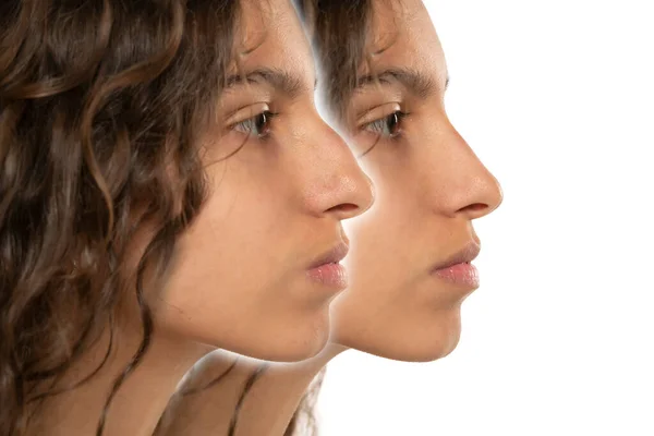 Woman Rhinoplasty Women Nose Shape Plastic Surgery Woman Profile Side — Stock Photo, Image