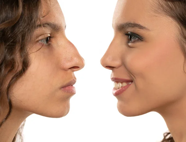 Nasenkorrektur Bei Frauen Frauen Nasenform Vor Und Nach Der Plastischen — Stockfoto