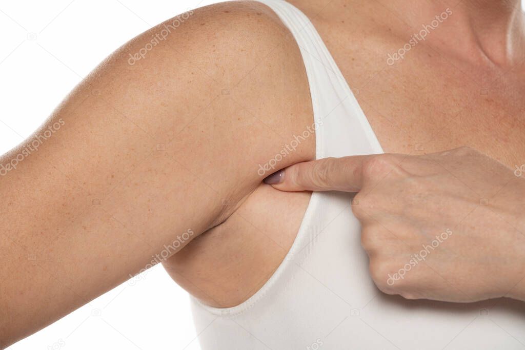 Cirugía Quitar Grasa De Brazos Cirugía Estética Eliminar Grasa De