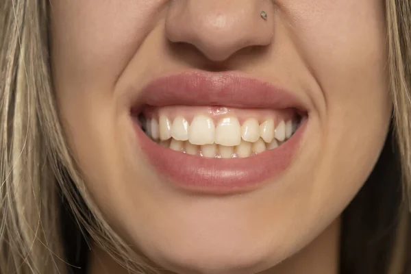 Femeia Tânără Își Arată Dinții Frumoși Sănătoși — Fotografie, imagine de stoc