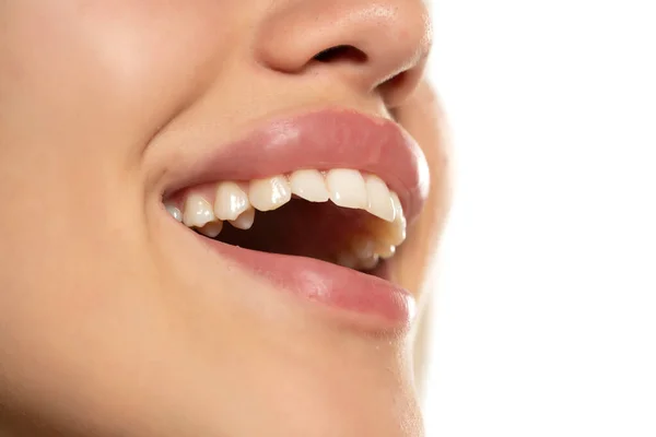 Skrattande Kvinna Mun Med Stora Friska Vita Tänder — Stockfoto