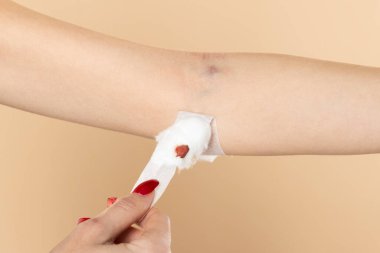 Kadın hasta pamuk kanamasının durduğunu gösteriyor. Kolesterolü, kan basıncını ve şeker seviyesini ölçmek için her yıl yapılan fiziksel sağlık testlerinden sonra.