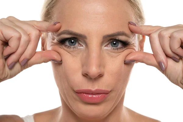 Portrait Middle Aged Woman Pinching Her Wrinkles Next Her Eyes — Stock Photo, Image