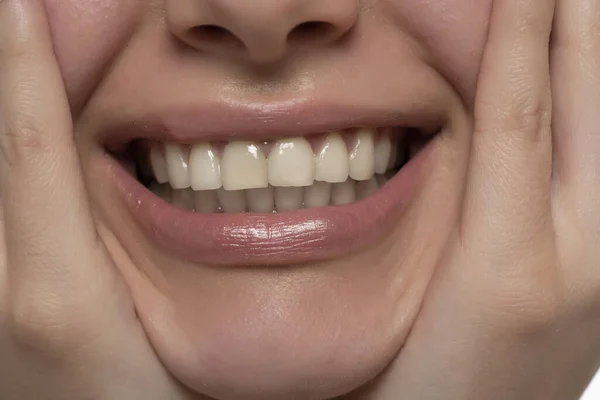 Belo Sorriso Mulher Jovem Com Dentes Brancos Saudáveis — Fotografia de Stock