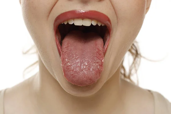 Zbliżenie Górę Kobieta Usta Przyklejając Język Biały Studio Tło — Zdjęcie stockowe