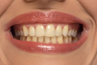 Bir kadının ağzına yakın çekim, kendine güvenen bir gülümseme, mükemmel doğal dişler ve dudaklar yakalıyor..