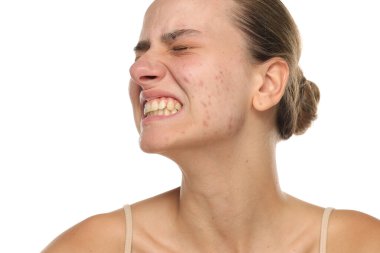 Akne dişlerini sıkmış genç bir kadının stüdyo fotoğrafı. Beyaz arka planda çıplak deri.