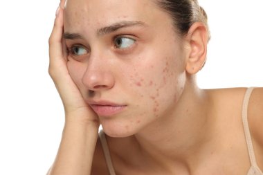 Stüdyoda, yüzü sivilceli, canı sıkkın ve üzgün görünen genç bir kadın vardı.