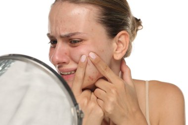 Sivilceli, ağrılı, beyaz arka planda izole genç bir kadının stüdyo fotoğrafı..