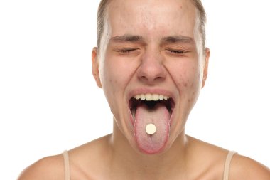 Sivilceli, dilini çıkarıp hap tutan, gözleri kapalı, beyaz arka planda stüdyo çekimi yapan genç bir kadın..