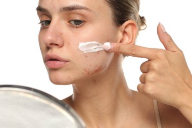 Sivilceli genç bir kadın aynaya yüz kremi sürüyor. Stüdyo resmi beyaz arka planda.