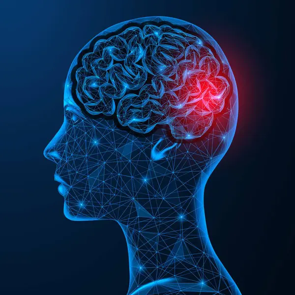 Beynin hipertansiyonu. Baş ağrısı veya kafanın oksipital bölgesinde damar hasarı. Düşük-poli tasarım, mavi arkaplan.