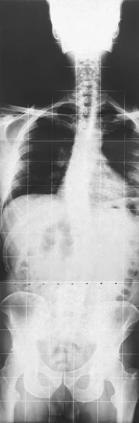 Ressonância Raios Espinha Masculina Diagnóstico Procedimento Médico Radiologia — Fotografia de Stock
