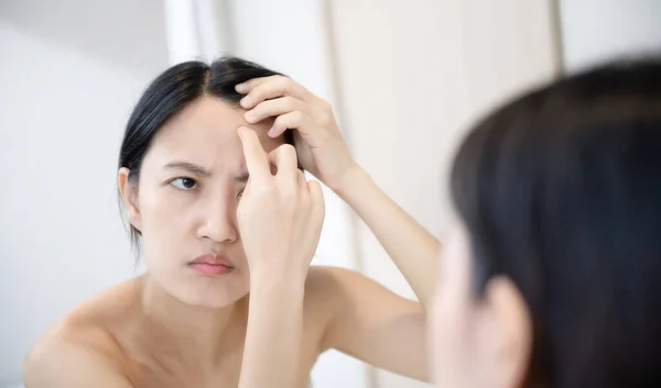 Pele Problemática Concerned Young Asian Women Popping Pimple Cheek While — Fotografia de Stock