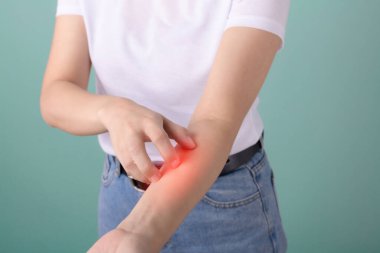 Kırmızı iltihaplı bölgeyle tahriş olmuş kolunu kaşıyan biri cilt tahrişi ya da alerjik reaksiyon gösterir.