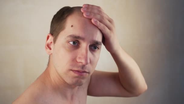 在家里 一个男人在镜子前刮光了他的秃头 脱发问题 — 图库视频影像