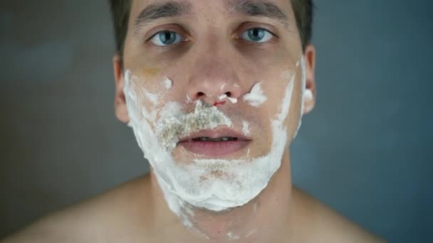 顔を剃った後にカットします 鋭い剃刀で毎日剃った後の刺激的な顔の皮膚 男は彼のひげと口ひげを剃るための朝の手順を実行します — ストック動画