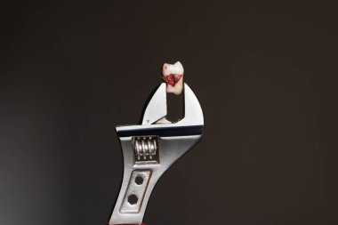 Diş çekilmesi, dişçi muayenehanesinde çalışan profesyonel bir stamatolog tarafından dişçi malzemeleriyle. Yirmilik diş tutan pense. Diş hekimi kavramı