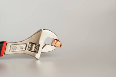 Diş çekilmesi, dişçi muayenehanesinde çalışan profesyonel bir stamatolog tarafından dişçi malzemeleriyle. Yirmilik diş tutan pense. Diş hekimi kavramı