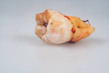 İnsan yirmilik dişi gri arka planda izole edilmiş. Dişçi konsepti. Yirmilik dişin makro fotoğrafı. Yaklaş.