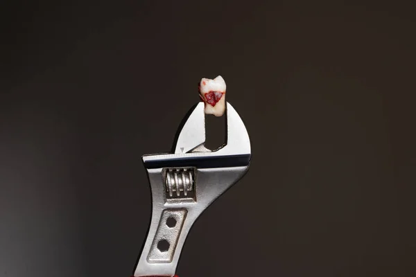 Tooth extraction with dental tools with caries by a professional stamatologist in a dental office. Pliers holding a wisdom tooth. Dentistry concept